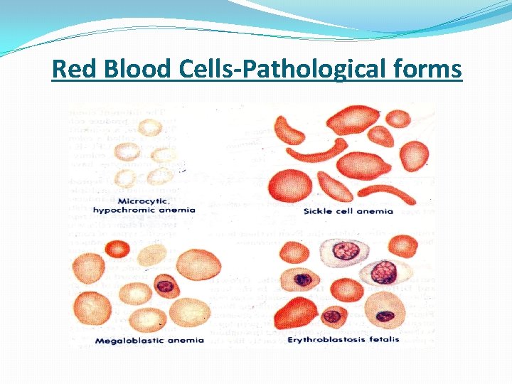  Red Blood Cells-Pathological forms 