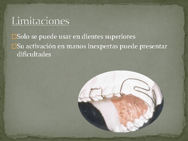 Limitaciones �Solo se puede usar en dientes superiores �Su activación en manos inexpertas puede