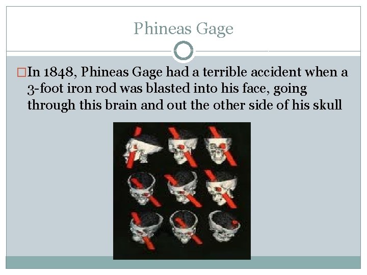 Phineas Gage �In 1848, Phineas Gage had a terrible accident when a 3 -foot