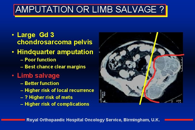 AMPUTATION OR LIMB SALVAGE ? • Large Gd 3 chondrosarcoma pelvis • Hindquarter amputation