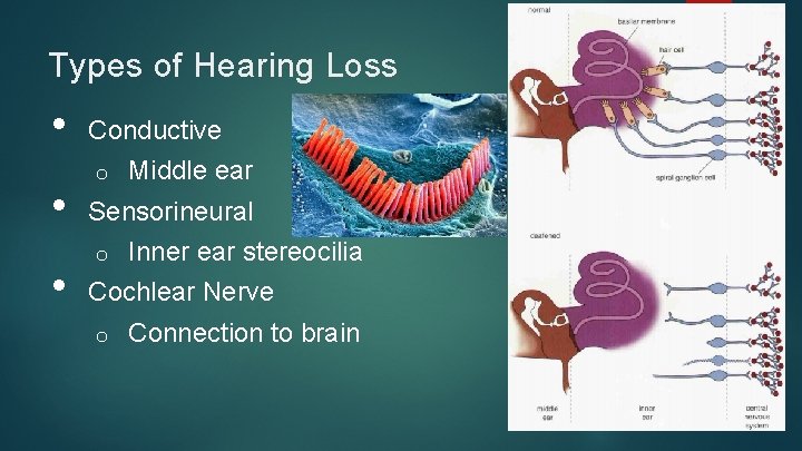 Types of Hearing Loss • • • Conductive o Middle ear Sensorineural o Inner