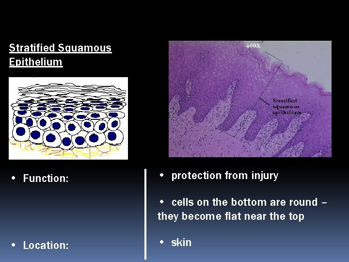 Stratified Squamous Epithelium • Function: • protection from injury • cells on the bottom