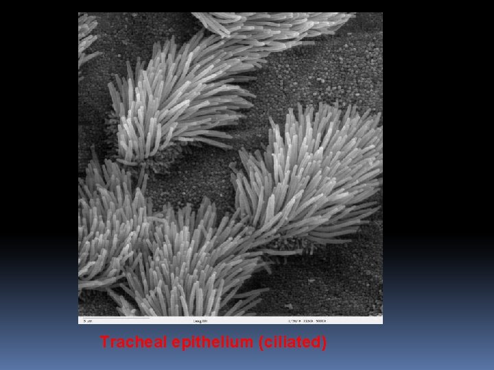 Tracheal epithelium (ciliated) 