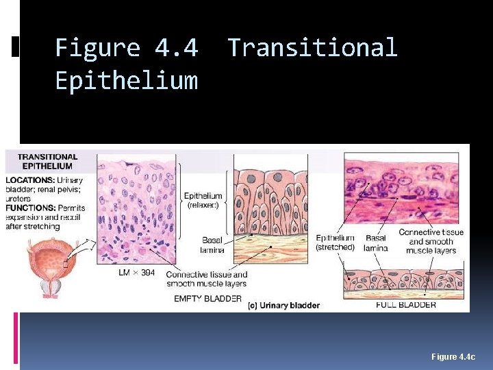 Figure 4. 4 Epithelium Transitional Figure 4. 4 c 