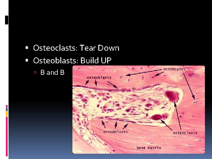  Osteoclasts: Tear Down Osteoblasts: Build UP B and B 