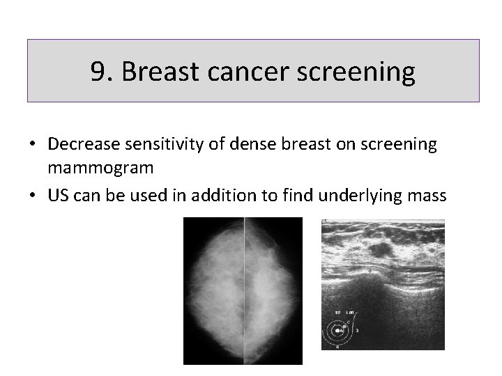 9. Breast cancer screening • Decrease sensitivity of dense breast on screening mammogram •