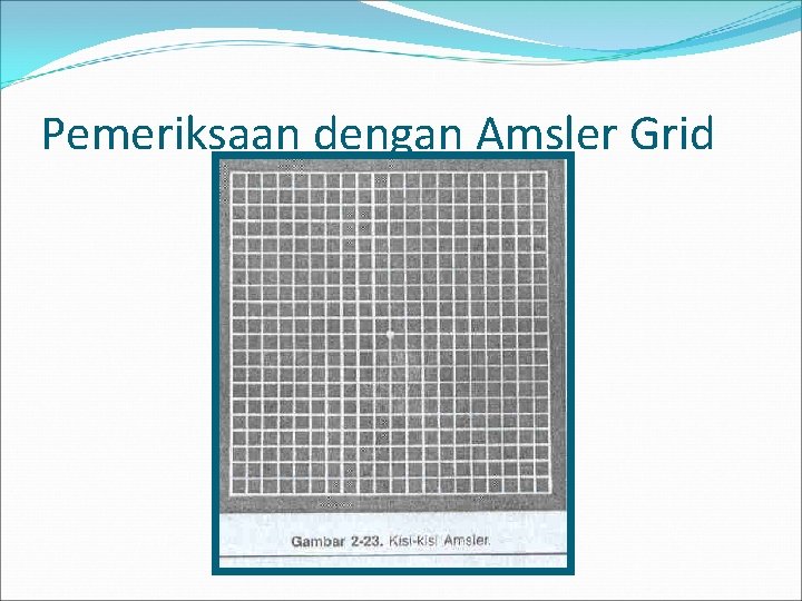 Pemeriksaan dengan Amsler Grid 