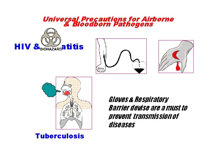 Universal Precautions for Airborne & Bloodborn Pathogens HIV & Hepatitis Gloves & Respiratory Barrier