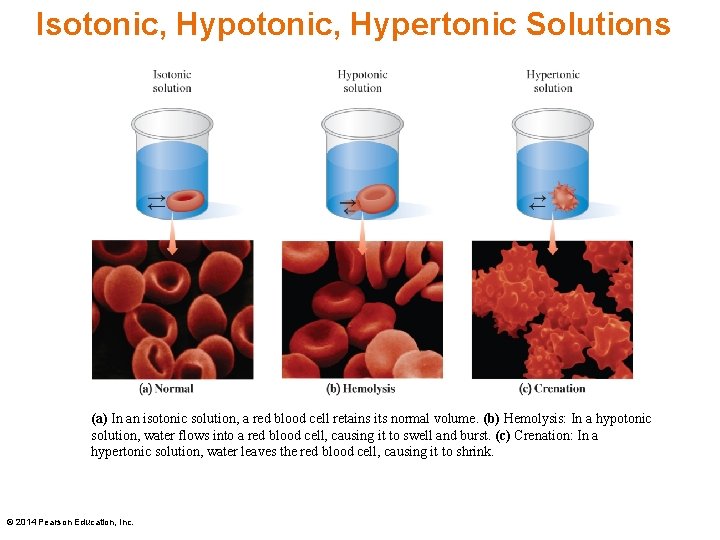 Isotonic, Hypertonic Solutions (a) In an isotonic solution, a red blood cell retains its