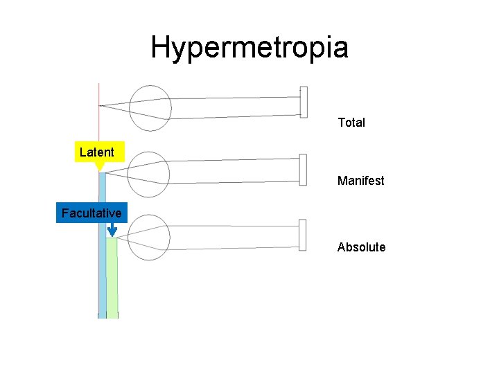 Hypermetropia Total Latent Manifest Facultative Absolute 