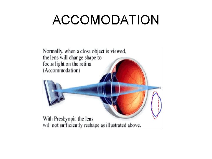 ACCOMODATION 