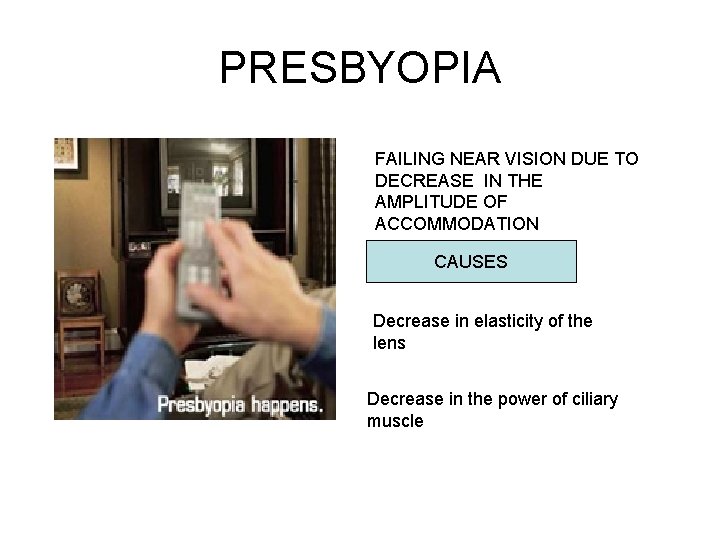PRESBYOPIA FAILING NEAR VISION DUE TO DECREASE IN THE AMPLITUDE OF ACCOMMODATION CAUSES Decrease
