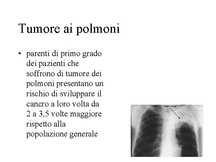 Tumore ai polmoni • parenti di primo grado dei pazienti che soffrono di tumore