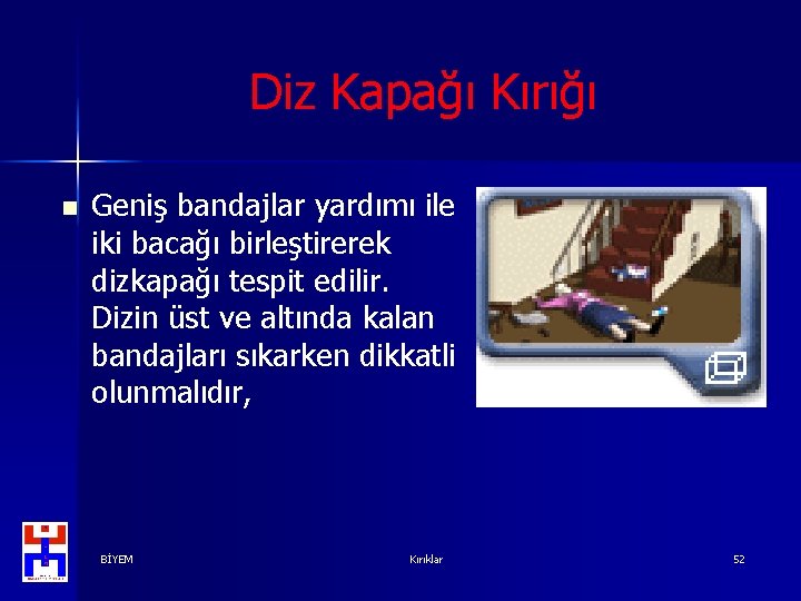 Diz Kapağı Kırığı n Geniş bandajlar yardımı ile iki bacağı birleştirerek dizkapağı tespit edilir.