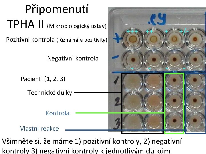 Připomenutí TPHA II (Mikrobiologický ústav) Pozitivní kontrola (různá míra pozitivity) Negativní kontrola +++ ++