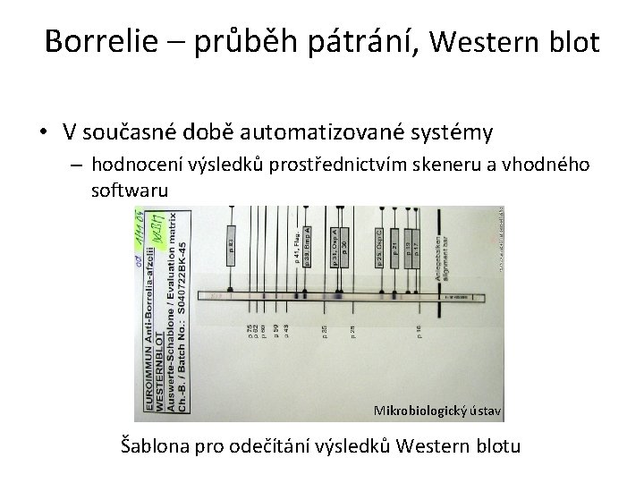 Borrelie – průběh pátrání, Western blot • V současné době automatizované systémy – hodnocení