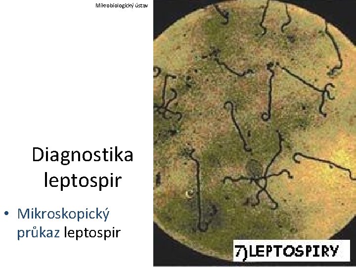 Mikrobiologický ústav Diagnostika leptospir • Mikroskopický průkaz leptospir 