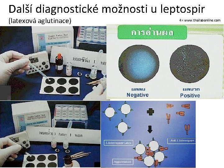 Další diagnostické možnosti u leptospir (latexová aglutinace) 4× www. thailabonline. com 
