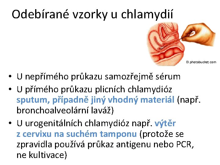 Odebírané vzorky u chlamydií i 9. photobucket. com • U nepřímého průkazu samozřejmě sérum