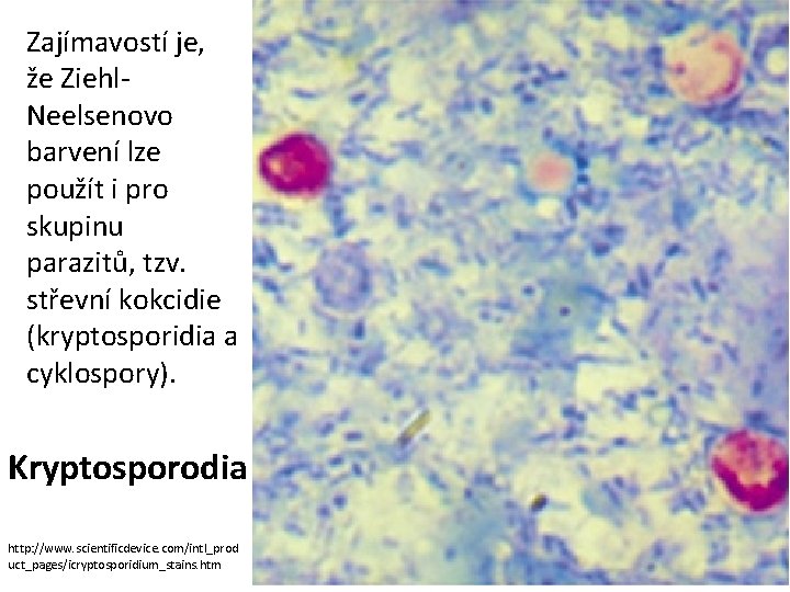 Zajímavostí je, že Ziehl. Neelsenovo barvení lze použít i pro skupinu parazitů, tzv. střevní