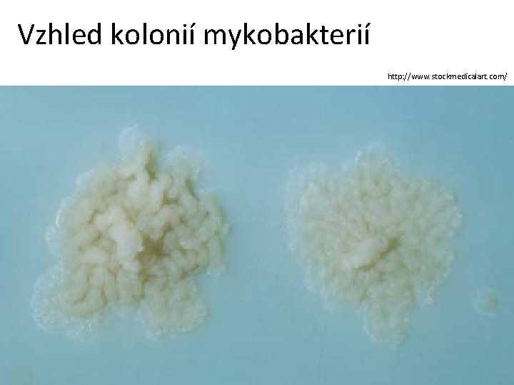 Vzhled kolonií mykobakterií http: //www. stockmedicalart. com/ 