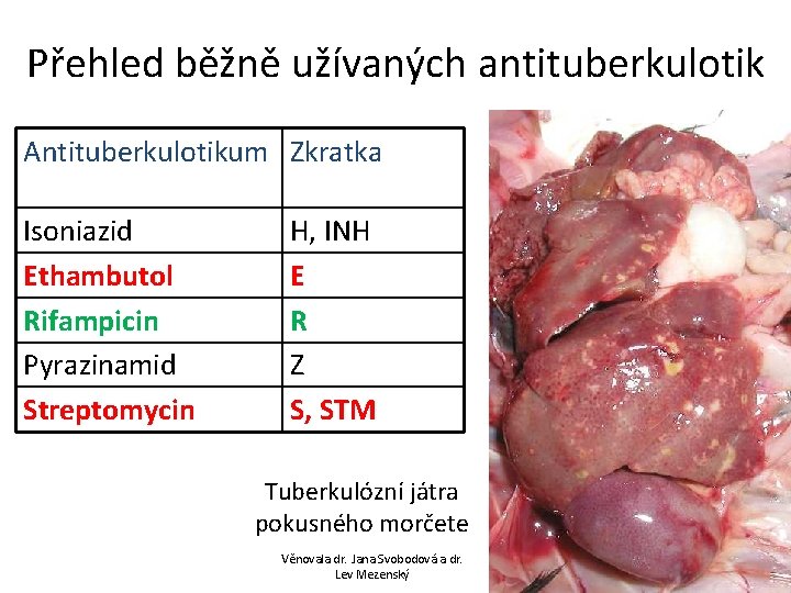 Přehled běžně užívaných antituberkulotik Antituberkulotikum Zkratka Isoniazid Ethambutol Rifampicin Pyrazinamid Streptomycin H, INH E