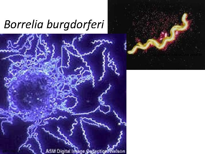 Borrelia burgdorferi http: //www. presse. uni-wuppertal. de gemi. mpl. ird. fr 