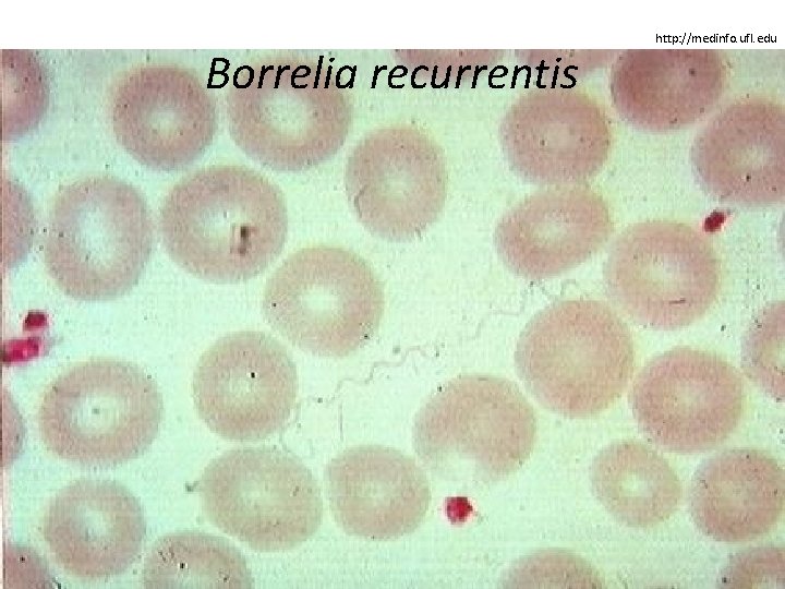 Borrelia recurrentis http: //medinfo. ufl. edu 