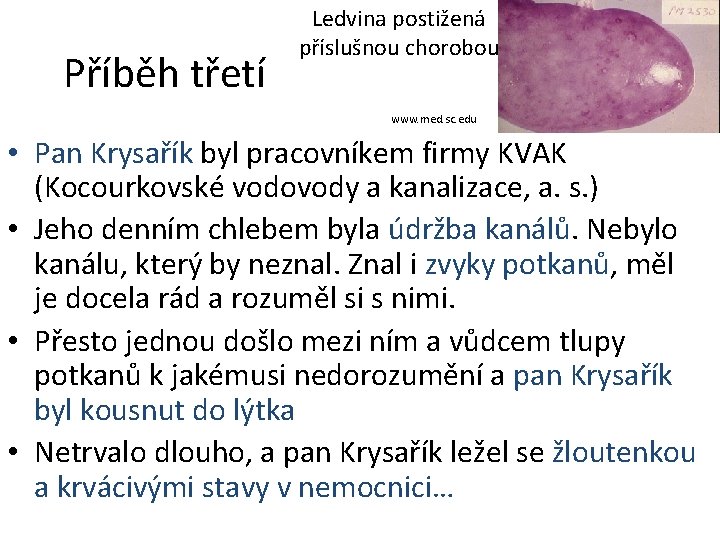 Příběh třetí Ledvina postižená příslušnou chorobou www. med. sc. edu • Pan Krysařík byl