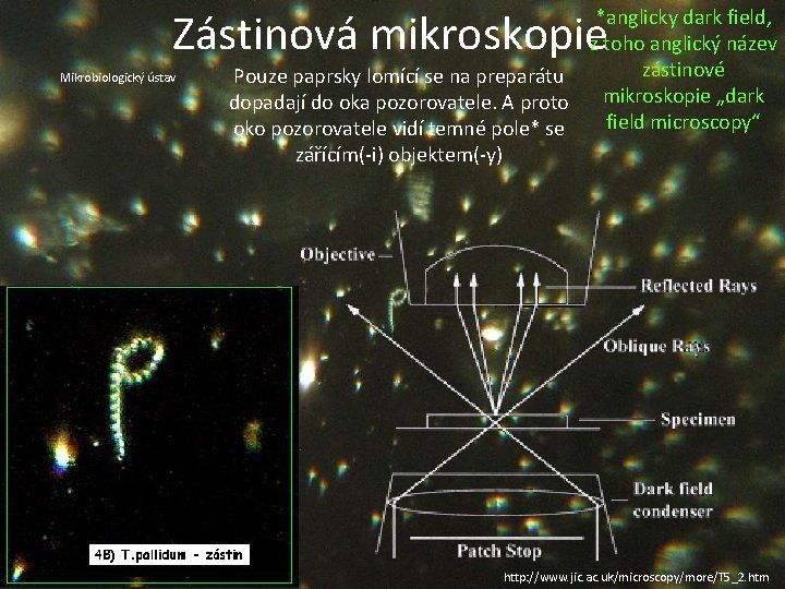 Zástinová mikroskopie Mikrobiologický ústav *anglicky dark field, z toho anglický název zástinové Pouze paprsky