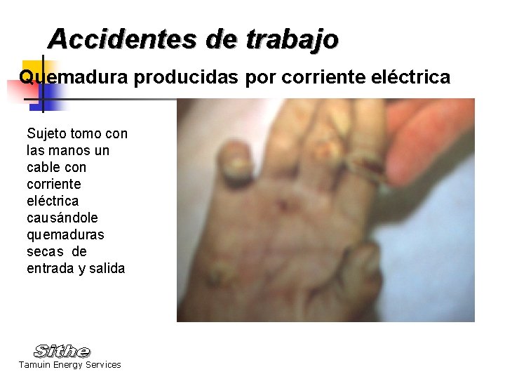 Accidentes de trabajo Quemadura producidas por corriente eléctrica Sujeto tomo con las manos un