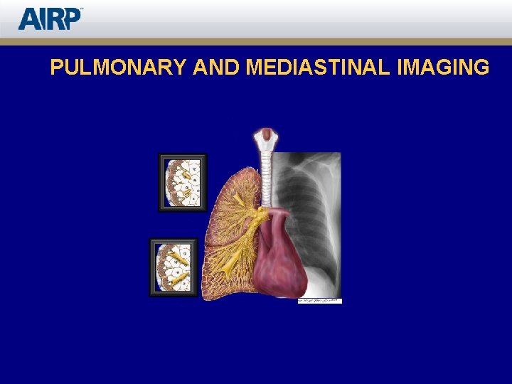 PULMONARY AND MEDIASTINAL IMAGING 