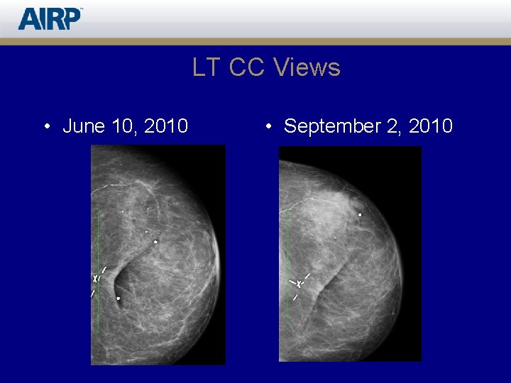 LT CC Views • June 10, 2010 • September 2, 2010 