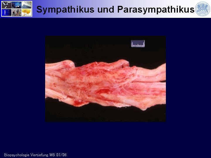 Sympathikus und Parasympathikus Biopsychologie Vertiefung WS 07/08 
