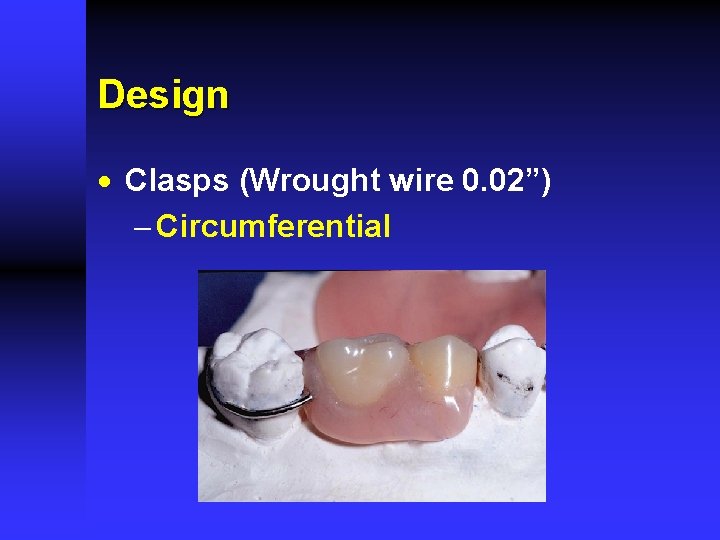 Design · Clasps (Wrought wire 0. 02”) - Circumferential 
