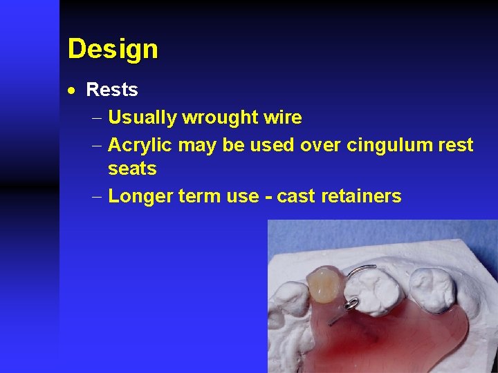 Design · Rests - Usually wrought wire - Acrylic may be used over cingulum