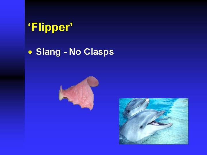 ‘Flipper’ · Slang - No Clasps 