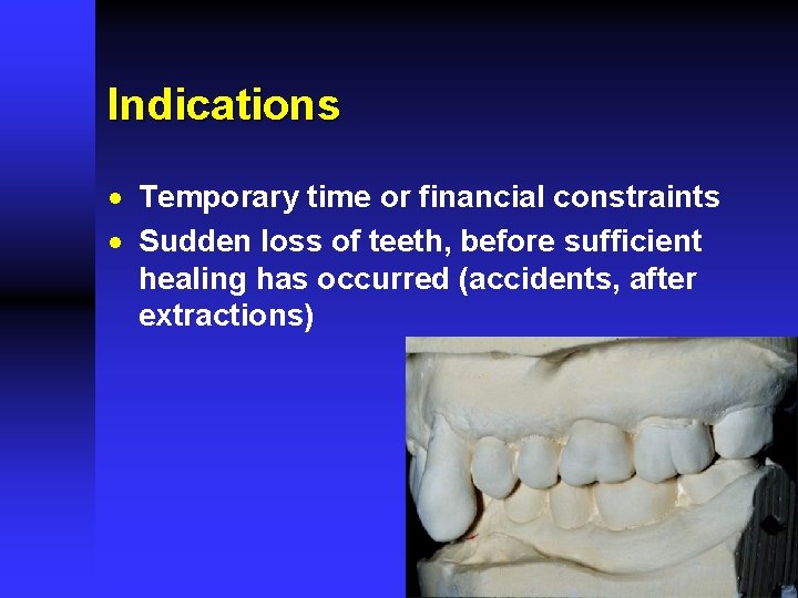 Indications · Temporary time or financial constraints · Sudden loss of teeth, before sufficient