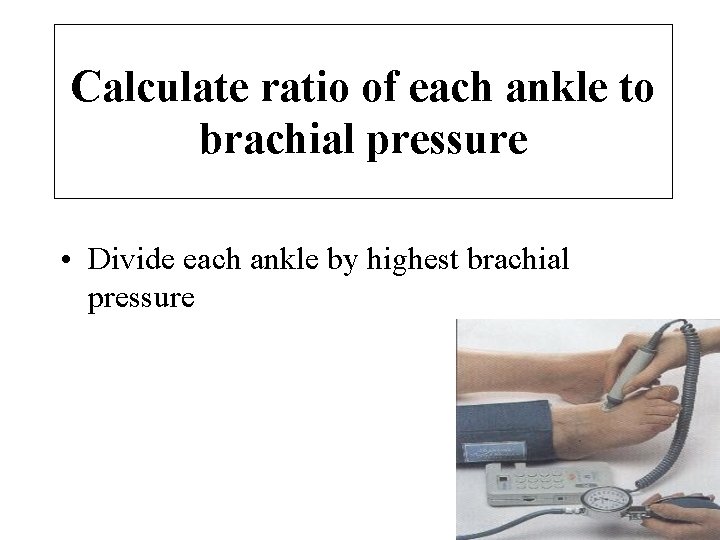 Calculate ratio of each ankle to brachial pressure • Divide each ankle by highest