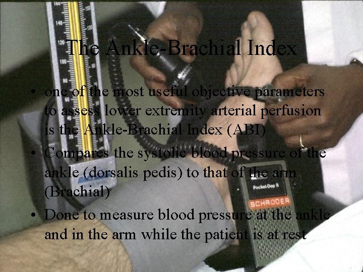The Ankle-Brachial Index • one of the most useful objective parameters to assess lower