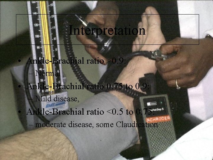 Interpretation • Ankle-Brachial ratio >0. 9: – Normal • Ankle-Brachial ratio 0. 75 to