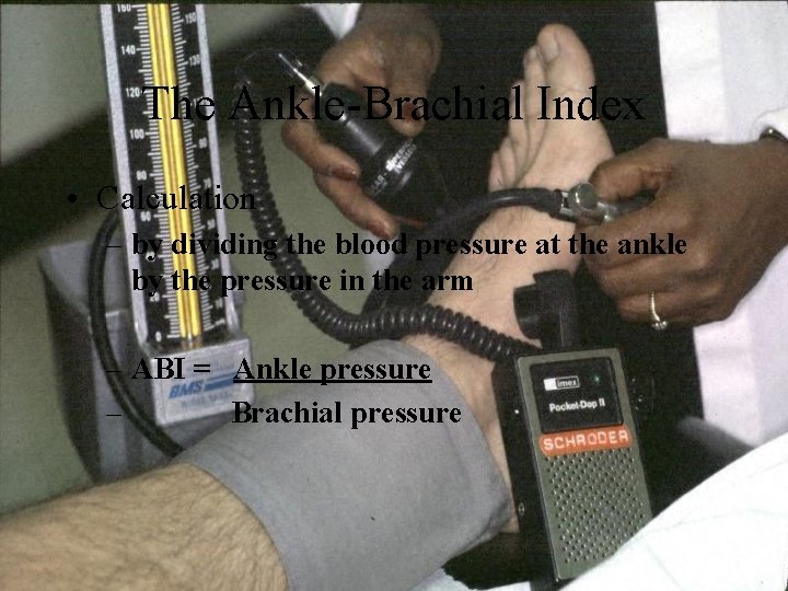 The Ankle-Brachial Index • Calculation – by dividing the blood pressure at the ankle