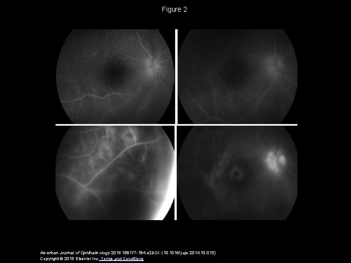 Figure 2 American Journal of Ophthalmology 2015 159177 -184. e 2 DOI: (10. 1016/j.