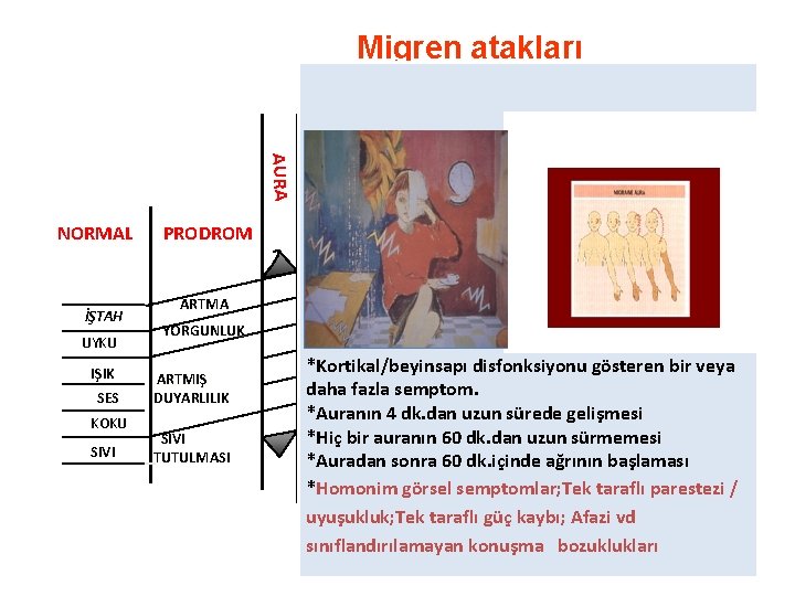 Migren atakları AĞRI AURA NORMAL BAŞAĞRISI PRODROM İYİLEŞME POSTDROM NORMAL BULANTI-KUSMA UYUKLAMA İŞTAH UYKU