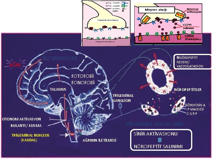 MENİNGİAL KAN DAMARI ÜST MERKEZLER NNÖROPEPTİT NEDENLİ VAZODİLATASYON AĞRI FOTOFOBİ FONOFOBİ TALAMUS NÖROPEPTİTLER TRİGEMİNAL