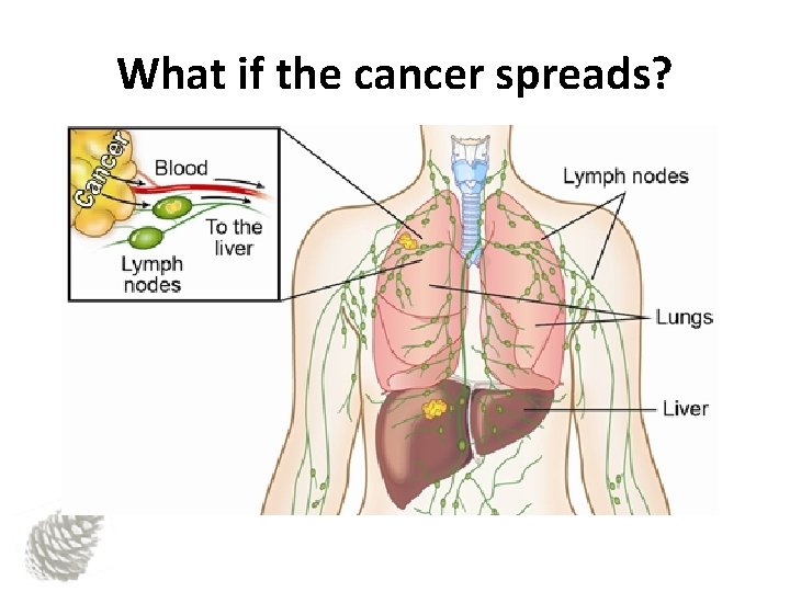 What if the cancer spreads? 