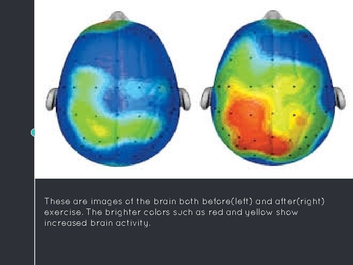 WANT BIG IMPACT? Use big image. These are images of the brain both before(left)