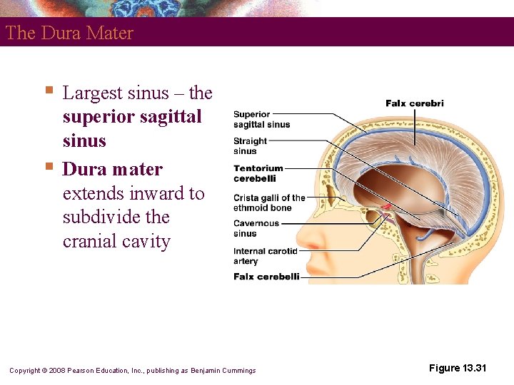 The Dura Mater § § Largest sinus – the superior sagittal sinus Dura mater
