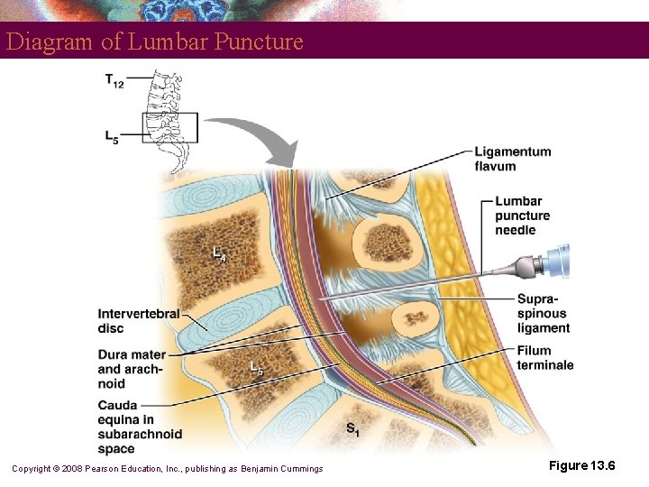 Diagram of Lumbar Puncture Copyright © 2008 Pearson Education, Inc. , publishing as Benjamin