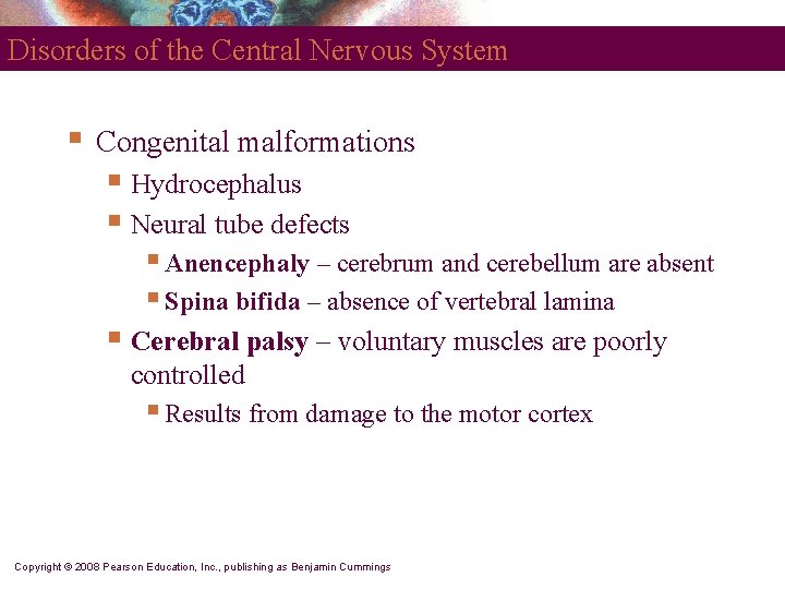 Disorders of the Central Nervous System § Congenital malformations § Hydrocephalus § Neural tube